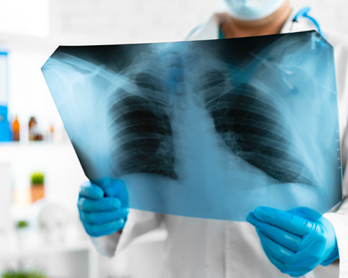 RADIATION EXPOSURE - Plaque for Radiation Protection