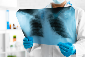 RADIATION EXPOSURE - Plaque for Radiation Protection